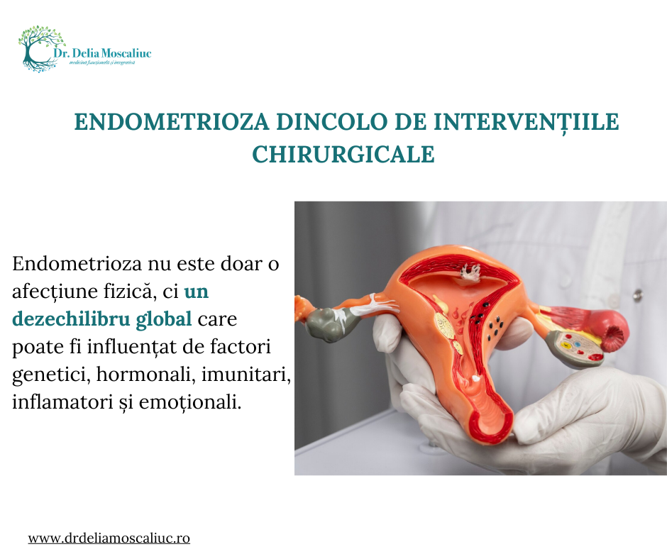 Endometrioza