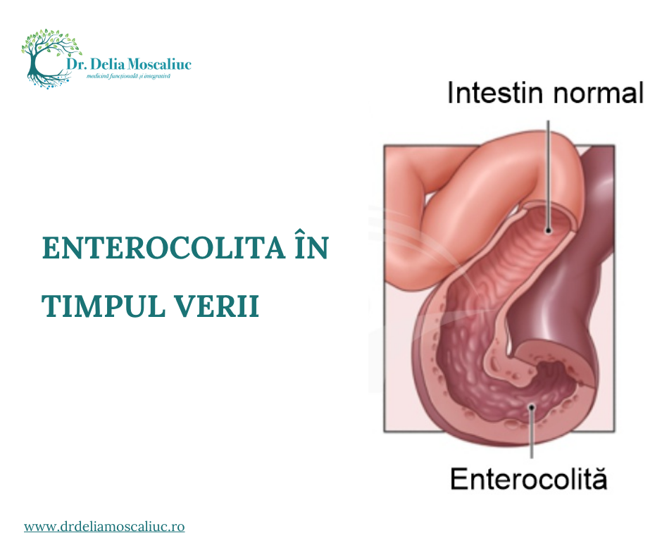 Enterocolita